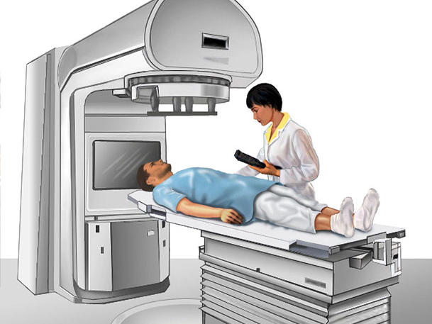 Radiation Therapies
